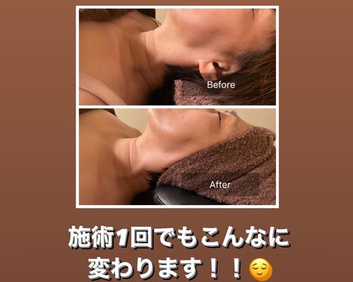 95C8A655-5C94-4DD0-B2FD-E0DBD9C2A941