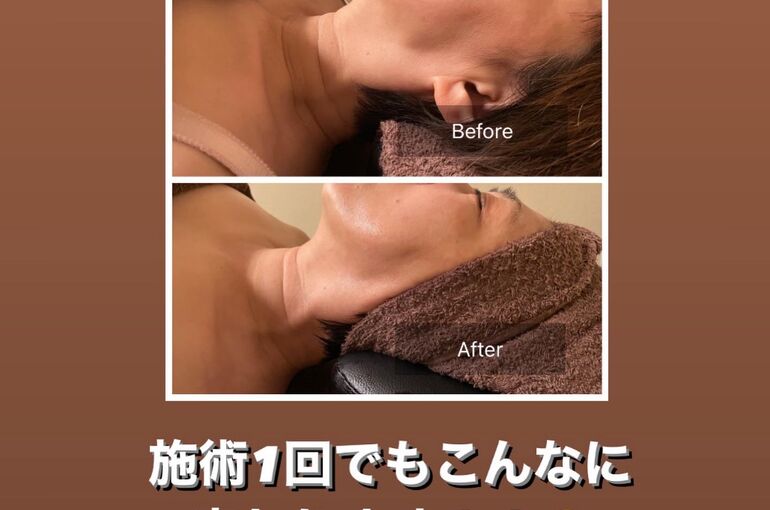 95C8A655-5C94-4DD0-B2FD-E0DBD9C2A941