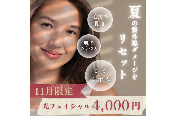 ベージュ シンプル 影 悩み 女性 日焼け 紫外線 Instagram 投稿 正方形