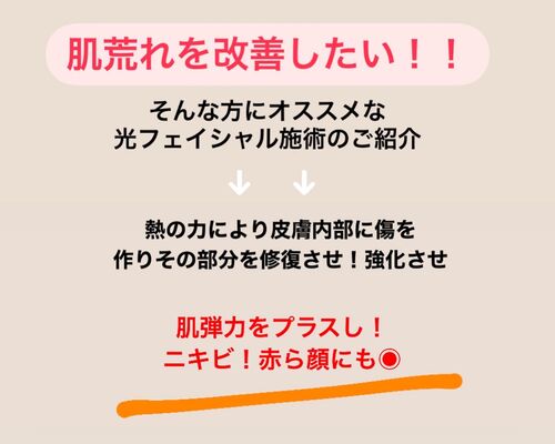 AEBB3560-1062-479B-BB75-7CC35E8A0DBE